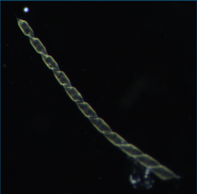 Diatom image
